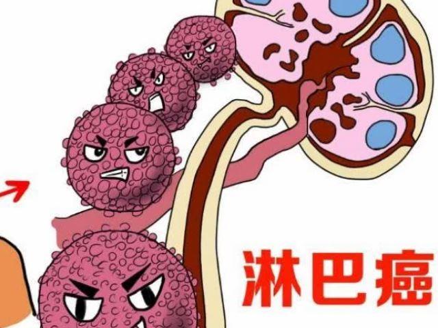 淋巴癌患者可以多吃哪些食物？这5种可增强免疫力