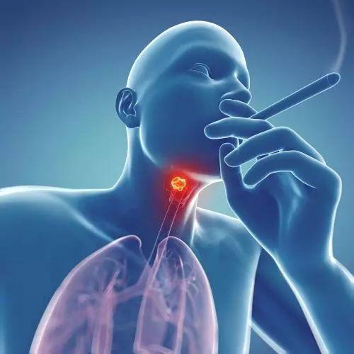 喉癌患者的饮食要注意什么？少吃刺激性强的食物