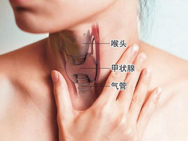 甲状腺癌早期有哪些不良症状？通常是这3种